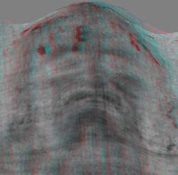 Sindone, perch&eacute; &egrave; &laquo;il calco della risurrezione&raquo; (altro che falso medievale)