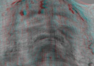 Sindone, perch&eacute; &egrave; &laquo;il calco della risurrezione&raquo; (altro che falso medievale)