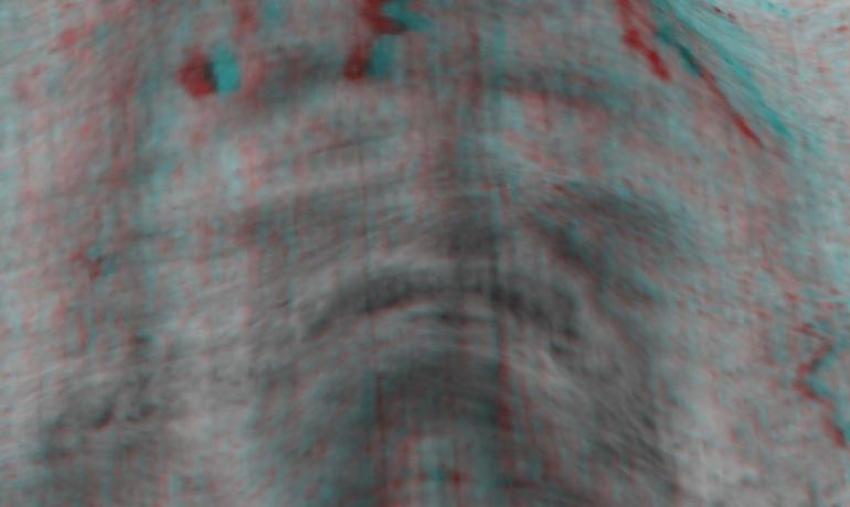 Sindone, perch&eacute; &egrave; &laquo;il calco della risurrezione&raquo; (altro che falso medievale)