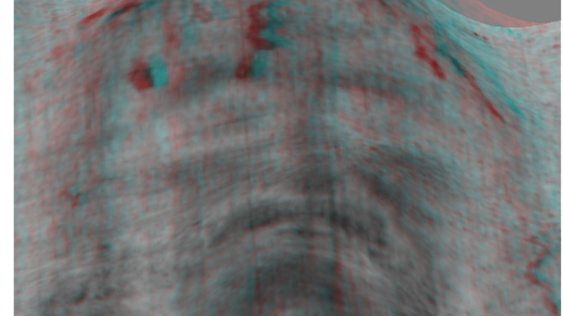 Sindone, perch&eacute; &egrave; &laquo;il calco della risurrezione&raquo; (altro che falso medievale)