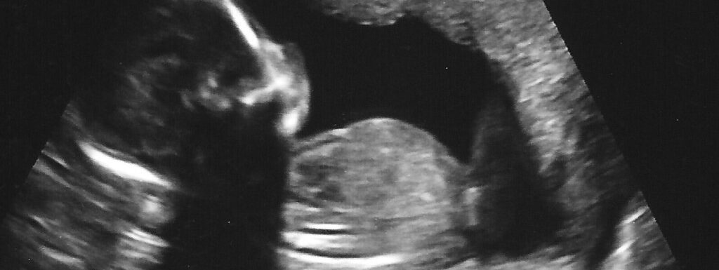 Stati Uniti, dal Congresso la proposta «Non chiamiamolo feto, ma bambino»