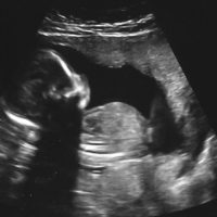 Stati Uniti, dal Congresso la proposta «Non chiamiamolo feto, ma bambino»